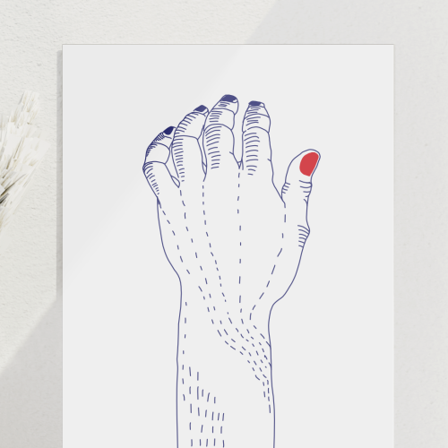 armdran | kunstdruck